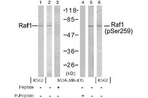 Image no. 2 for anti-V-Raf-1 Murine Leukemia Viral Oncogene Homolog 1 (RAF1) (pSer259) antibody (ABIN196618) (RAF1 antibody  (pSer259))