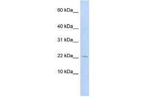 FKBP2 antibody used at 1 ug/ml to detect target protein. (FKBP2 antibody  (N-Term))