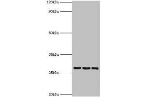 Western blot All lanes: 14-3-3 protein theta antibody at 4 μg/mL Lane 1: A549 whole cell lysate Lane 2: Mouse lung tissue Lane 3: HepG2 whole cell lysate Secondary Goat polyclonal to rabbit IgG at 1/10000 dilution Predicted band size: 28 kDa Observed band size: 28 kDa (14-3-3 theta antibody  (AA 1-245))