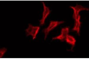 ABIN6274788 staining COLO205 by IF/ICC. (ABHD12 antibody)