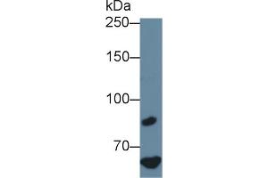 Factor VIII antibody  (AA 1854-1988)