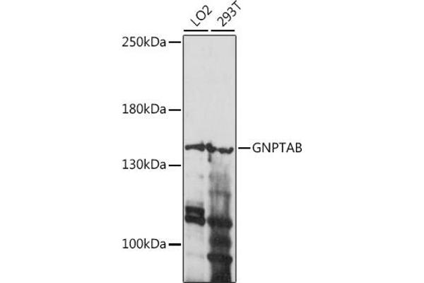 GNPTAB 抗体  (AA 42-350)