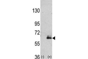 Western blot analysis of anti-MAP2 antibody and 293 cell lysate (2 ug/lane) either nontransfected (Lane 1) or transiently transfected with the hMAP2-Q425 gene (2). (MAP2 antibody  (AA 1766-1796))