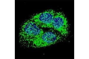Fluorescent confocal image of HepG2 cells stained with BNIP3 antibody at 1:50. (BNIP3 antibody  (AA 152-187))