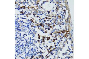 Immunohistochemistry of paraffin-embedded human tonsil using USO1 antibody (ABIN5971479) at dilution of 1/100 (40x lens).