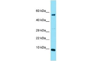 Host: Rabbit Target Name: C20orf166 Sample Type: Jurkat Whole Cell lysates Antibody Dilution: 1. (C20orf166 antibody  (N-Term))