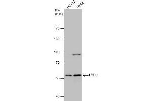 Western Blotting (WB) image for anti-Glucose-6-Phosphate Dehydrogenase (G6PD) antibody (ABIN2854975)