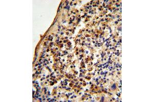 Formalin-fixed and paraffin-embedded mouse spleen tissue reacted with Ku70 Antibody (Center), which was peroxidase-conjugated to the secondary antibody, followed by DAB staining. (XRCC6 antibody  (AA 432-461))