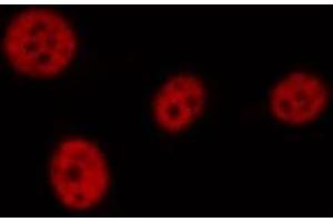 ABIN6276926 staining HT29 by IF/ICC. (LIG1 antibody  (Internal Region))
