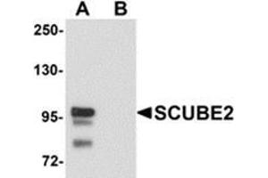 Western blot analysis of SCUBE2 in Daudi cell lysate with SCUBE2 antibody at 1 μg/ml in (A) the absence and (B) the presence of blocking peptide. (SCUBE2 antibody  (Center))