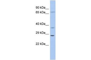 WB Suggested Anti-ASCL1 Antibody Titration: 0. (ASCL1 antibody  (Middle Region))