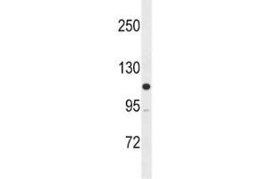 MLCK antibody western blot analysis in SK-BR-3 lysate (MYLK antibody  (AA 908-938))