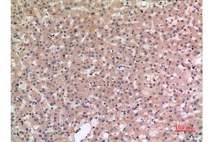 Immunohistochemistry (IHC) analysis of paraffin-embedded Human Liver, antibody was diluted at 1:100. (SLC10A1 antibody  (C-Term))