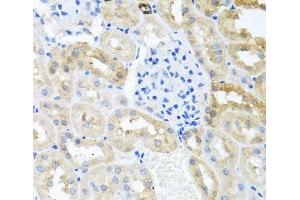 Immunohistochemistry of paraffin-embedded Rat kidney using MYLK Polyclonal Antibody at dilution of 1:100 (40x lens). (MYLK antibody)