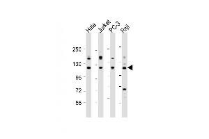 All lanes : Anti-REST Antibody (Center) at 1:2000 dilution Lane 1: Hela whole cell lysate Lane 2: Jurkat whole cell lysate Lane 3: PC-3 whole cell lysate Lane 4: Raji whole cell lysate Lysates/proteins at 20 μg per lane. (REST antibody  (AA 542-570))