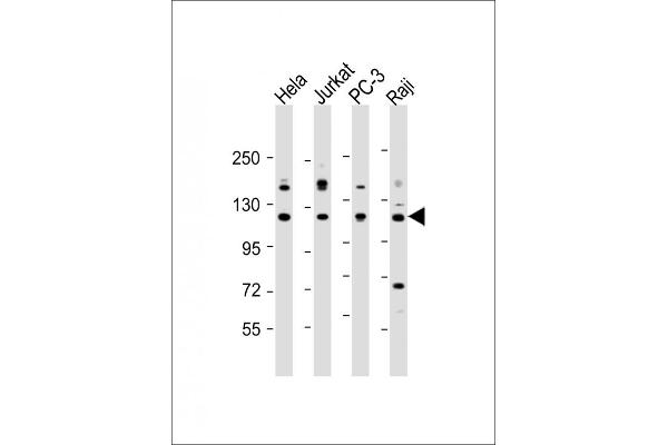 REST anticorps  (AA 542-570)