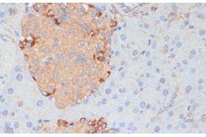 Immunohistochemistry of paraffin-embedded Mouse pancreas using PTPRN2 Polyclonal Antibody at dilution of 1:100 (40x lens).