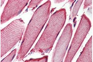 Human Skeletal Muscle (formalin-fixed, paraffin-embedded) stained with HSPB6 antibody ABIN364293 at 2. (HSPB6 antibody)