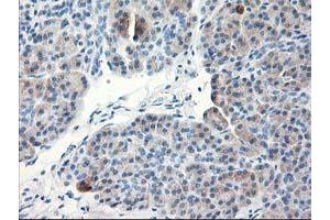 Immunohistochemical staining of paraffin-embedded Human pancreas tissue using anti-TBC1D21 mouse monoclonal antibody. (TBC1D21 antibody)