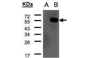 WB Image Western Blot analysis of ARHGAP1 expression in transfected 293T cell line by ARHGAP1 polyclonal antibody. (ARHGAP1 antibody  (N-Term))