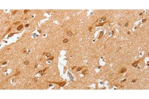 Immunohistochemistry of paraffin-embedded Human brain using cPLA2 Polyclonal Antibody at dilution of 1:50 (PLA2G4A antibody)