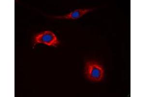 Immunofluorescent analysis of NPY2R staining in HeLa cells.