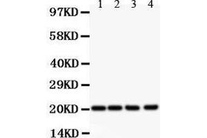 Western Blotting (WB) image for anti-Dihydrofolate Reductase (DHFR) (AA 2-187) antibody (ABIN3043286)