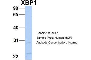 Host: Rabbit Target Name: NOP56 Sample Type: MCF7 Antibody Dilution: 1. (XBP1 antibody  (C-Term))