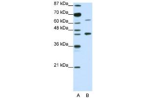 WB Suggested Anti-RARA Antibody Titration:  1. (Retinoic Acid Receptor alpha antibody  (N-Term))