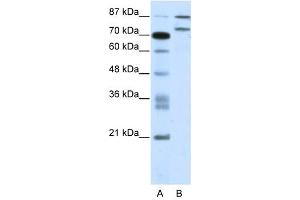 Western Blot showing ZNF709 antibody used at a concentration of 1-2 ug/ml to detect its target protein. (ZNF709 antibody  (N-Term))