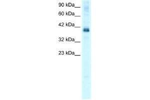 Human HepG2; WB Suggested Anti-TSC22D4 Antibody Titration: 0.