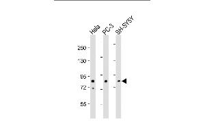 All lanes : Anti-DYRK1A Antibody (N-term) at 1:500-1:2000 dilution Lane 1: Hela whole cell lysate Lane 2: PC-3 whole cell lysate Lane 3: SH-SY5Y whole cell lysate Lysates/proteins at 20 μg per lane. (DYRK1A antibody  (N-Term))