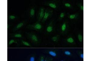 Immunofluorescence analysis of U-2 OS cells using ETS2 Polyclonal Antibody at dilution of 1:100. (ETS2 antibody)