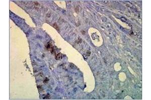 Immunohistochemistry (IHC) image for anti-Heat Shock Protein 70 (HSP70) antibody (ABIN263937) (HSP70 antibody)