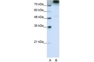 WB Suggested Anti-EIF3S9 Antibody Titration:  0.