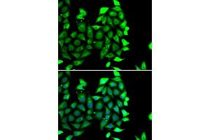 Immunofluorescence analysis of MCF-7 cells using IKZF3 antibody (ABIN6130489, ABIN6142290, ABIN6142291 and ABIN6223116). (IKZF3 antibody  (AA 280-450))
