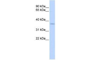WB Suggested Anti-SFXN3 Antibody Titration:  0. (SFXN3 antibody  (Middle Region))