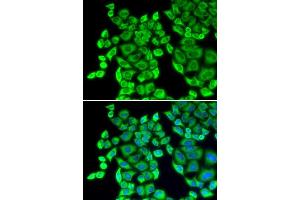 Immunofluorescence analysis of U20S cell using EEF1D antibody. (EEF1D antibody  (AA 1-160))