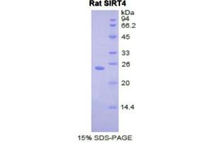 SDS-PAGE (SDS) image for Sirtuin 4 (SIRT4) (AA 60-255) protein (His tag) (ABIN2122094)