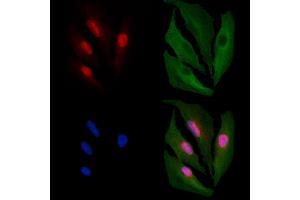 ABIN6261411 and ABIN6266531 staining  cells by IF/ICC. (E2F4 antibody  (N-Term))