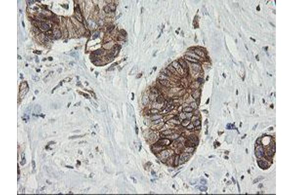 TAPBPL antibody