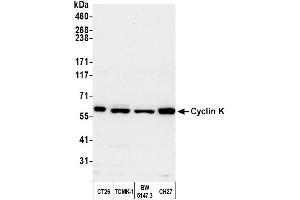 Western Blotting (WB) image for anti-Cyclin K (CCNK) (AA 530-580) antibody (ABIN7453581) (Cyclin K antibody  (AA 530-580))