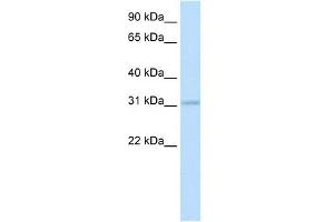 WB Suggested Anti-HOXD3 Antibody Titration:  0. (HOXD3 antibody  (N-Term))