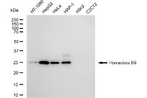 Western blotting analysis using Homeobox B9 antibody (ABIN7798993).