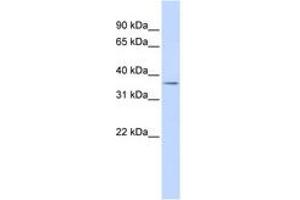 Image no. 1 for anti-Tripartite Motif Containing 69 (TRIM69) (AA 36-85) antibody (ABIN6742519) (TRIM69 antibody  (AA 36-85))