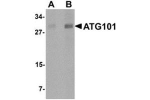 Western blot analysis of ATG101 in human liver tissue lysate with ATG101 antibody at (A) 1 and (B) 2 μg/ml. (ATG101 antibody  (Center))
