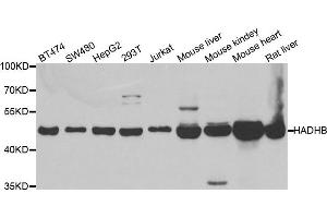 Western blot analysis of extracts of various cell lines, using HADHB antibody. (HADHB antibody)