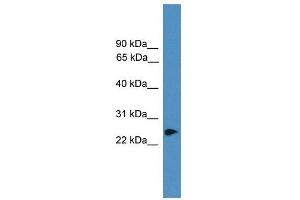 WB Suggested Anti-ZNF313  Antibody Titration: 0. (RNF114 antibody  (C-Term))