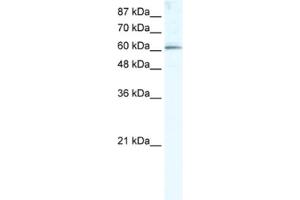 Western Blotting (WB) image for anti-Methyltransferase Like 3 (METTL3) antibody (ABIN2460997) (METTL3 antibody)