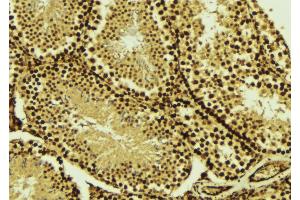 ABIN6269020 at 1/100 staining Mouse testis tissue by IHC-P. (TBP antibody  (N-Term))
